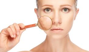 Pros and Cons of using lasers and other modalities for pigmentation
