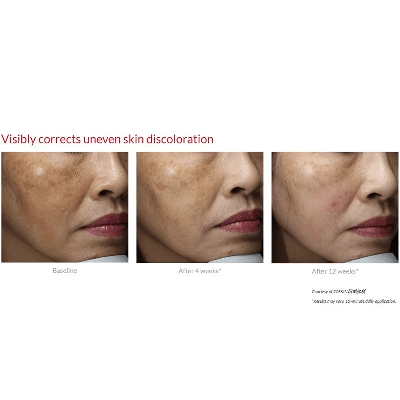 Cyspera Pigment Correction